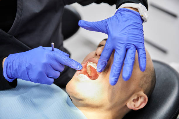 Best Emergency Root Canal Treatment in Bismarck, MO